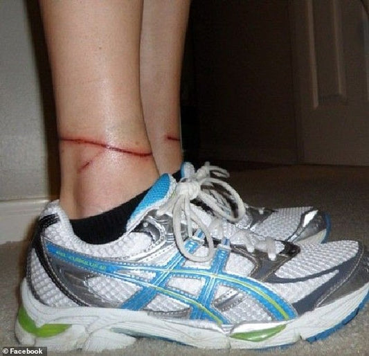 New Warnings about Dangers of Retractable Leads - WACKYwalk'r provides a safe alternative to Retractable Leashes